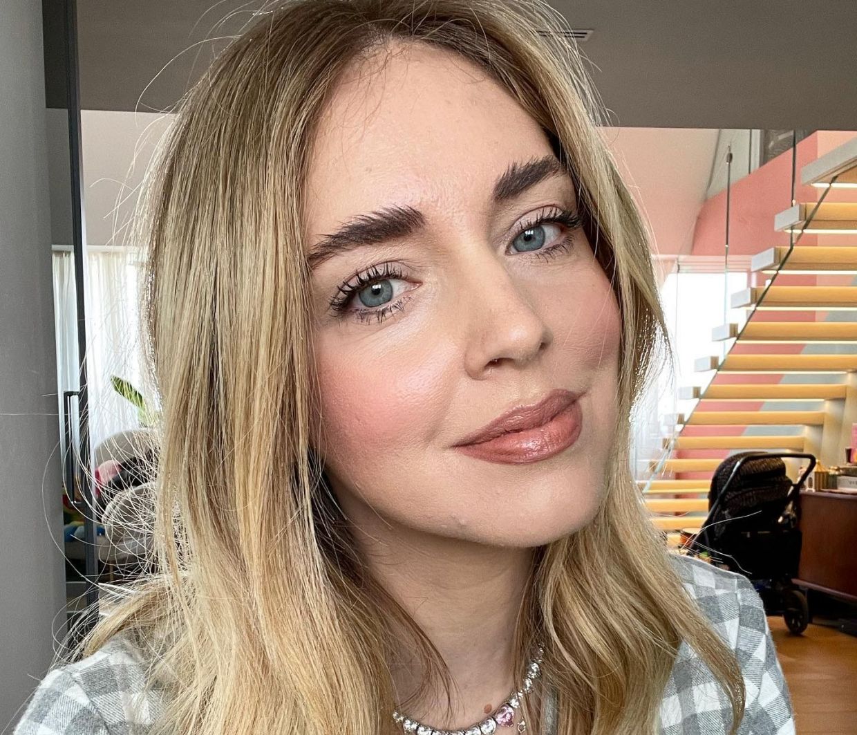 Το πρόβλημα υγείας που αντιμετώπισε η Chiara Ferragni μετά το εξιτήριο του Fedez από το νοσοκομείο