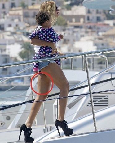 H Beyonce, το καυτό σορτς και η… κυτταρίτιδα!