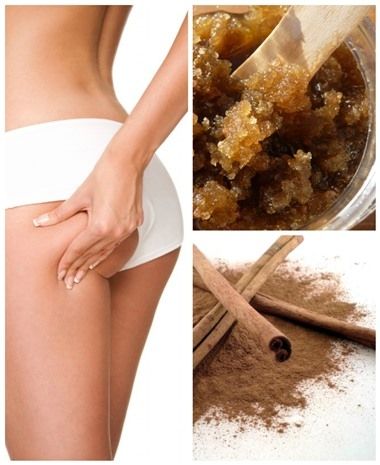 Φτιάξτε μόνες σας πανεύκολο και δραστικό scrub κανέλας και πείτε αντίο στην κυτταρίτιδα!