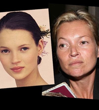 Kate Moss: 20 χρόνια μετά