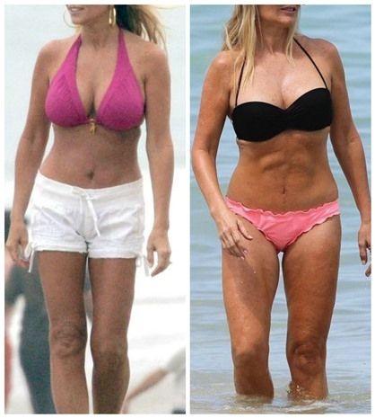 Ποια celebrity φημολογείται ότι έκανε κοιλιοπλαστική; (φωτό πριν+μετά)