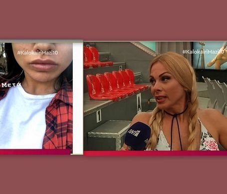 Ζώζα Μεταξά: «Τραγικό! Έξαλλη έγινα με την κόρη μου, Κόνι, που έβαλε χείλη! Τρελάθηκα»!