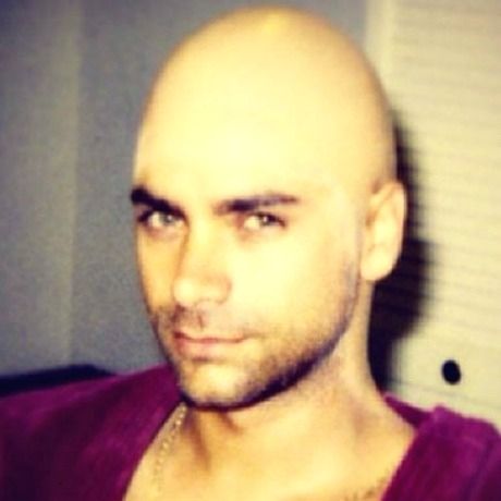 Ωχ, ο John Stamos έμεινε φαλακρός!