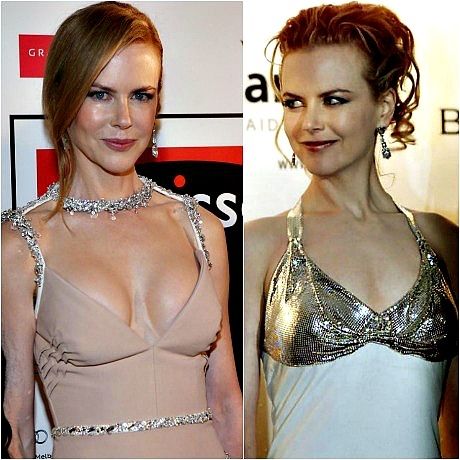 Με γεια το νέο στήθος! H Nicole Kidman αποφάσισε να τα μεγαλώσει!