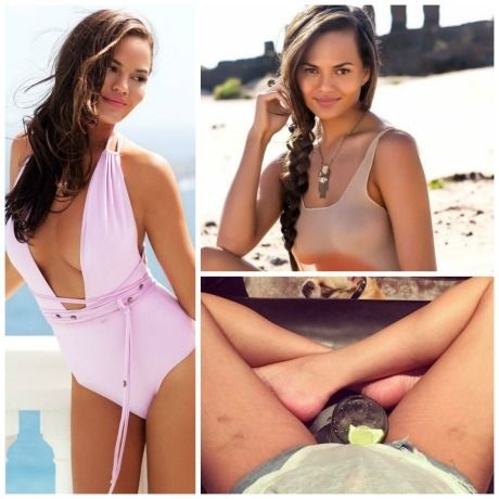 Μετά την Chrissy Teigen, άλλες 5 stars έχουν τολμήσει να μας δείξουν τις ατέλειές τους!