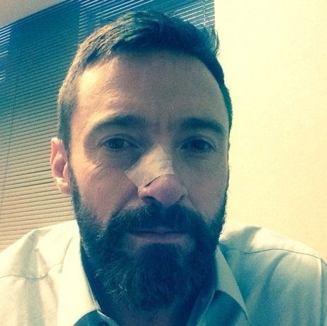 Δεύτερη εμφάνιση καρκινώματος στον Hugh Jackman. Δείτε τo μήνυμά του στο Twitter