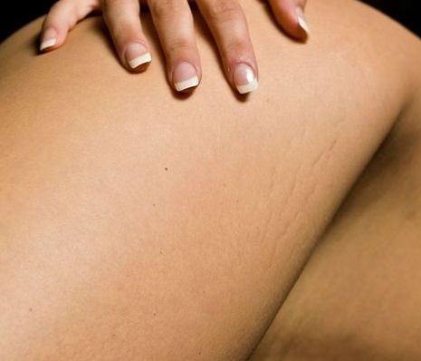 Έξυπνα τρικ για την κάλυψη των ραγάδων