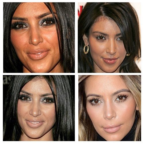Kim Kardashian. Όσο μεγαλώνει, ομορφαίνει. (Με τη βοήθεια του πλαστικού πάντα!)