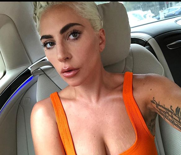 11 celebrities που δε διστάζουν να δείξουν τις ραγάδες τους