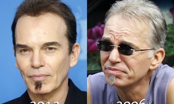 O Billy Bob Thornton μοιάζει με κέρινο ομοίωμα από το πολύ botox