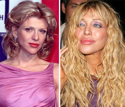 Σα να παραφούσκωσαν! Ποιες stars έχουν κάνει αποτυχημένες επεμβάσεις στα χείλη τους; (photos)