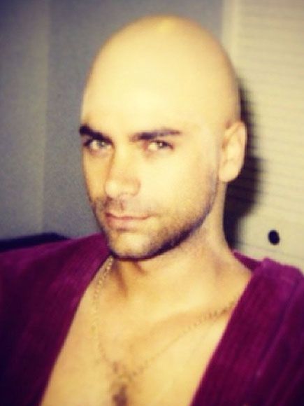Ωχ, ο John Stamos έμεινε φαλακρός!