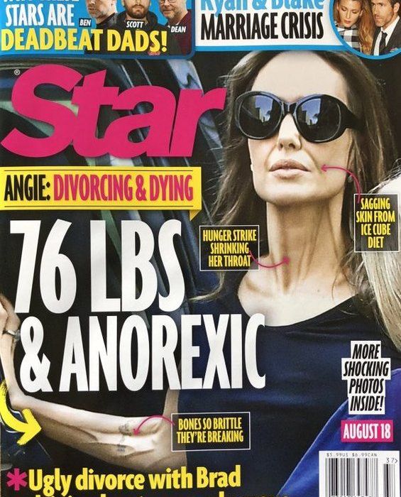Αδυνάτισε πάλι επικίνδυνα η Angelina Jolie και η ανησυχία για την υγεία της μεγαλώνει