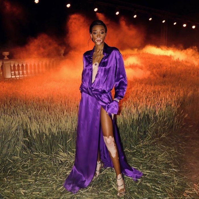 Winnie Harlow, 24