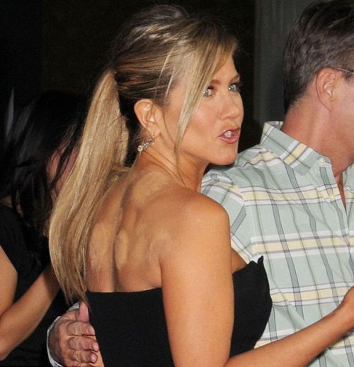 Η Jennifer Aniston κάνει βεντούζες