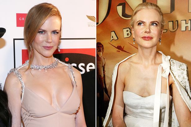 Με γεια το νέο στήθος! H Nicole Kidman αποφάσισε να τα μεγαλώσει!