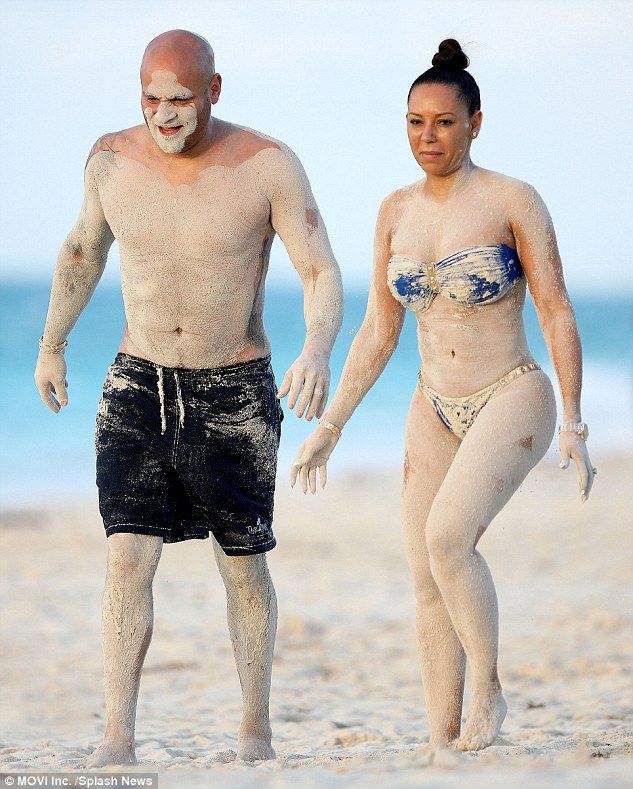 Mel B: Το αποκαλυπτικό ατύχημα στην παραλία
