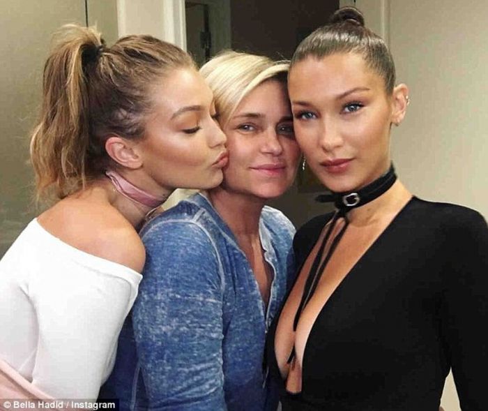 H σοκαριστική φωτογραφία του supermodel και η μάχη της με τη σοβαρή ασθένεια