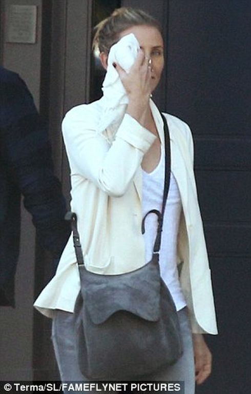 Οι πρώτες φωτογραφίες της Cameron Diaz έξω από τον πλαστικό χειρουργό