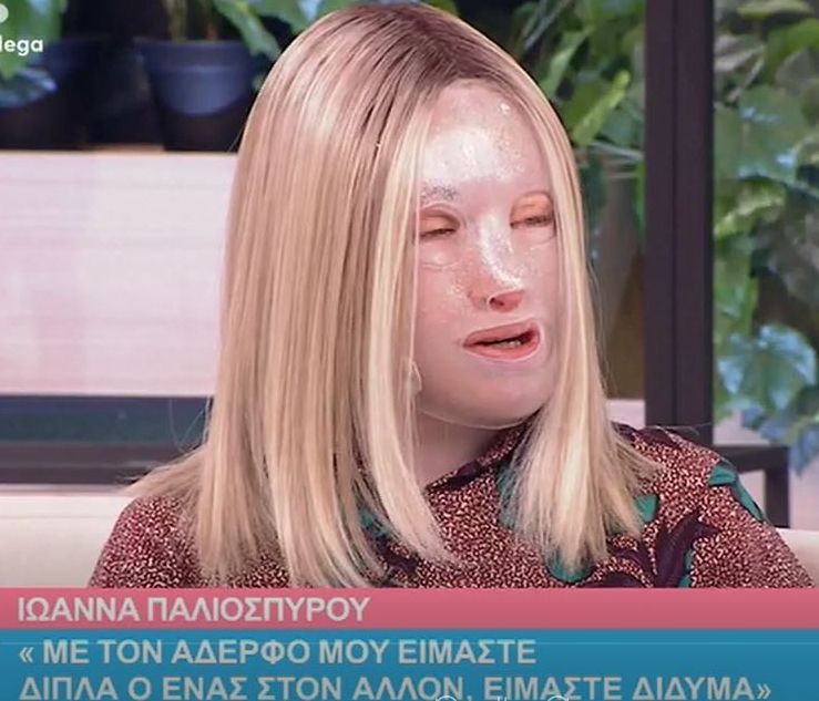 Η Ιωάννα Παλιοσπύρου στο Χαμογέλα Και Πάλι: Τα ρούχα από την επίθεση και η φωτογραφία χωρίς μάσκα
