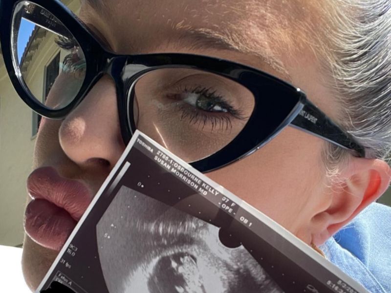 Η Kelly Osbourne περιμένει το πρώτο της παιδί και μας δείχνει τον πρώτο υπέρηχο του μωρού της