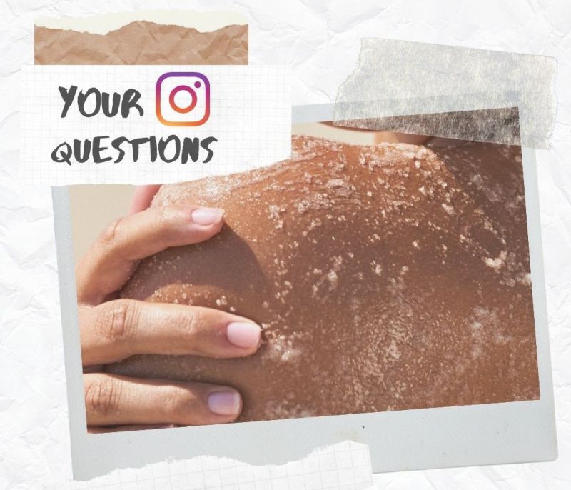 Your insta-questions: Με την απολέπιση φεύγει το μαύρισμά μου;