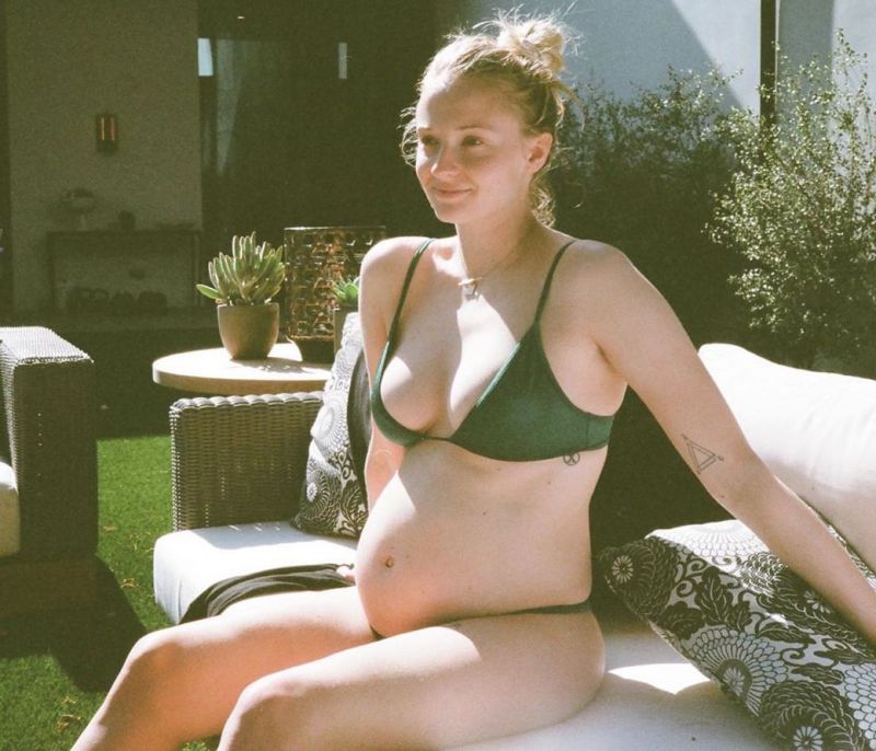 Sophie Turner: Το εντυπωσιακό της σώμα δυόμιση μήνες μετά τη γέννα