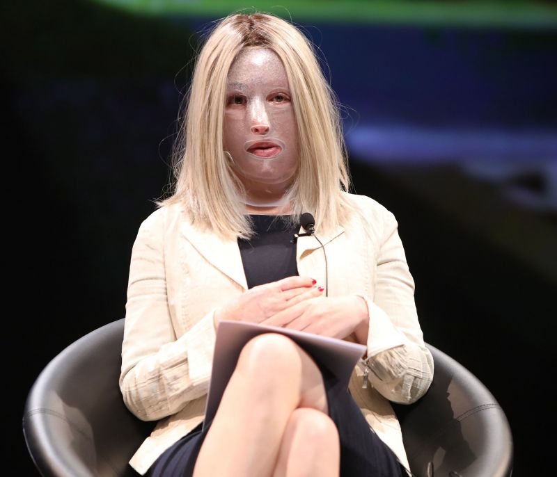 Η Ιωάννα Παλιοσπύρου γυμνάζεται ξανά: Όσα αποκάλυψε η προπονήτριά της - Τι ακριβώς συνέβη στη Γαλλία