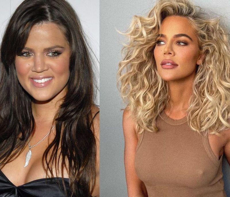 Το πρόσωπο της Khloe Kardashian έχει αλλάξει τελείως: Οι μεγάλες διαφορές από το 2007 ως σήμερα