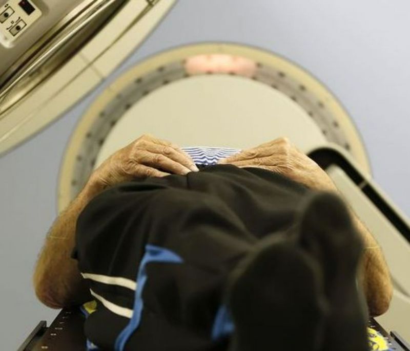 Η ενιαία μαγνητική τομογραφία διαγιγνώσκει τη μελέτη Αλτσχάιμερ πρώιμου και προχωρημένου σταδίου