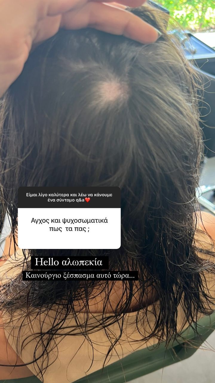 alopekia.jpg