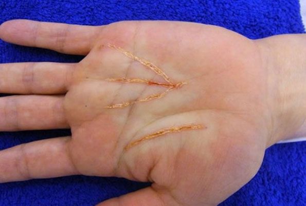 palm-reading-surgery-1