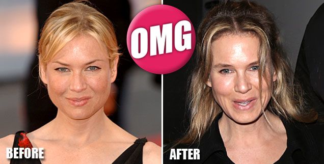 renee zellweger before and after wide