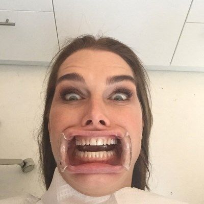 rs 600x600-150123165543-600.brooke-shields-dentist