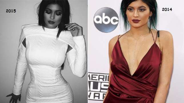 kylie-jenner-boobs-enlargement b910d