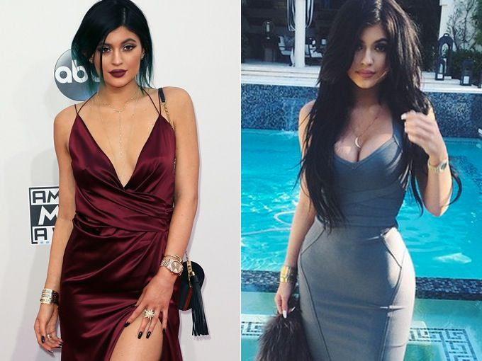 kylie-jenner-breast-implants-transformation 84682